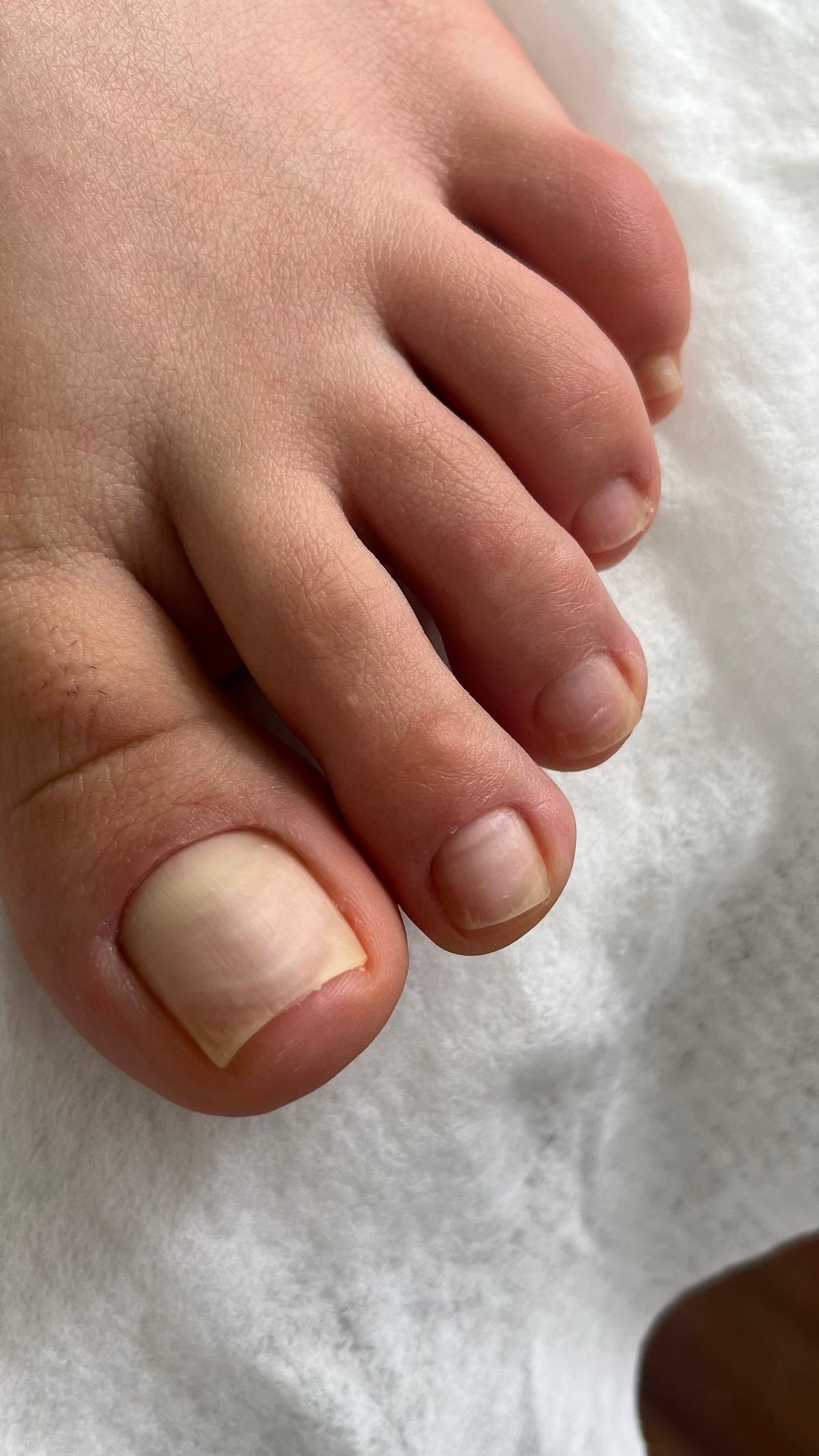 Classic Pedicure